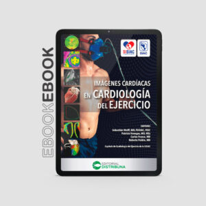 Imágenes cardiacas en cardiología del ejercicio