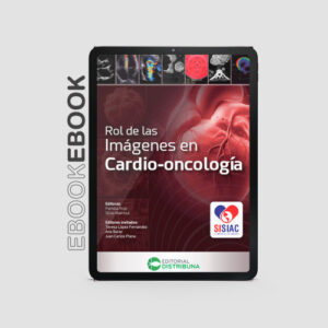 Rol de las imágenes en cardio-oncología